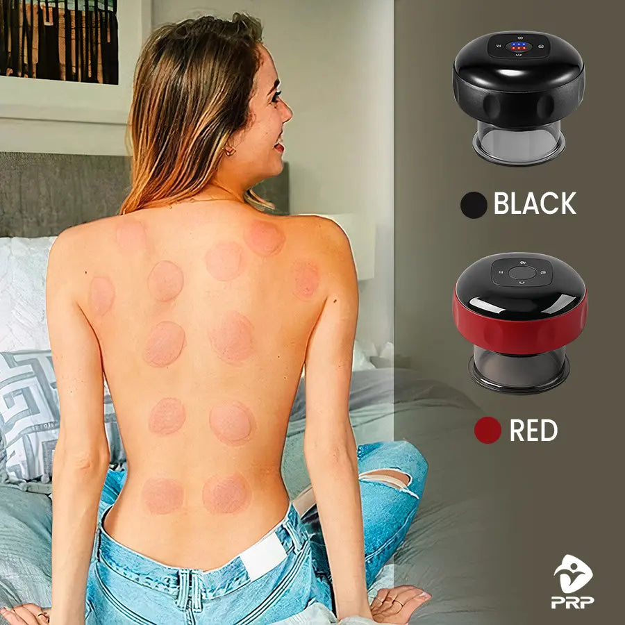 A woman facing away, showing the round cupping marks on her back, sitting on a bed next to two PRP ThermCup models in black and red, showcasing the available color options.
